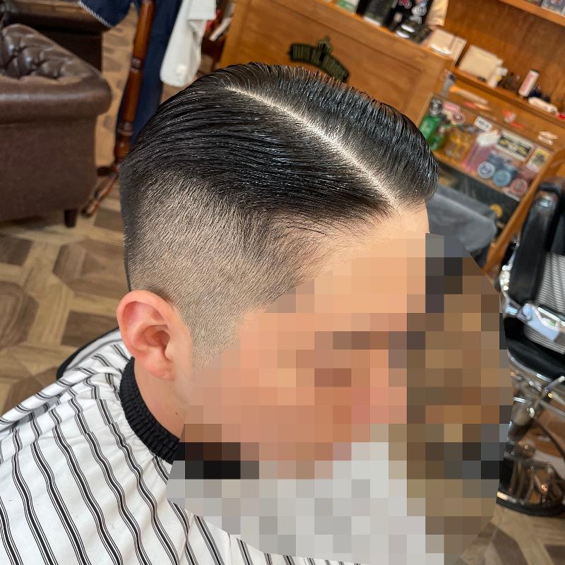 시술사진1>