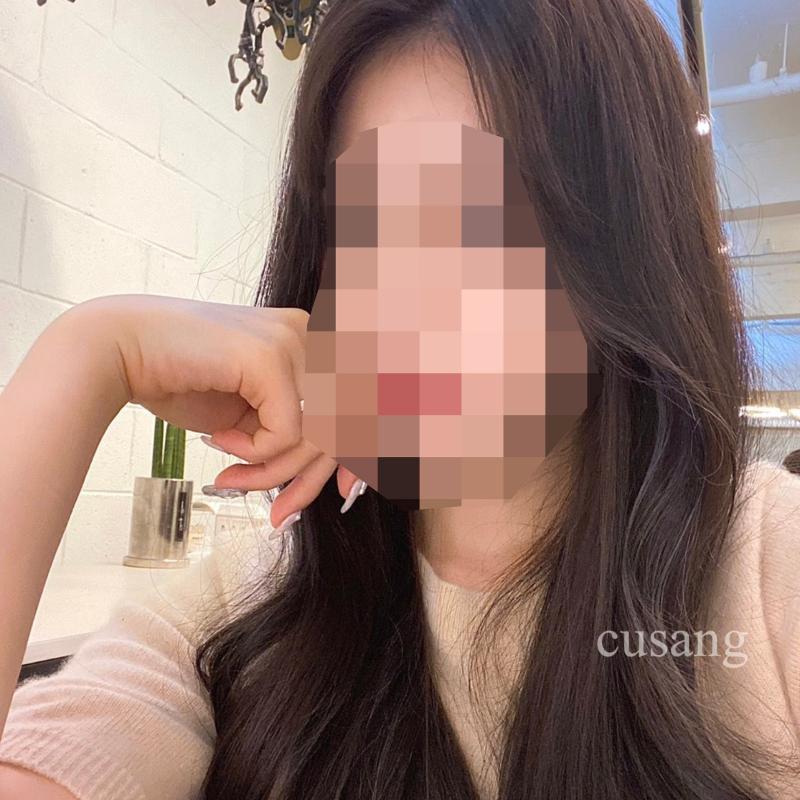 시술사진1>