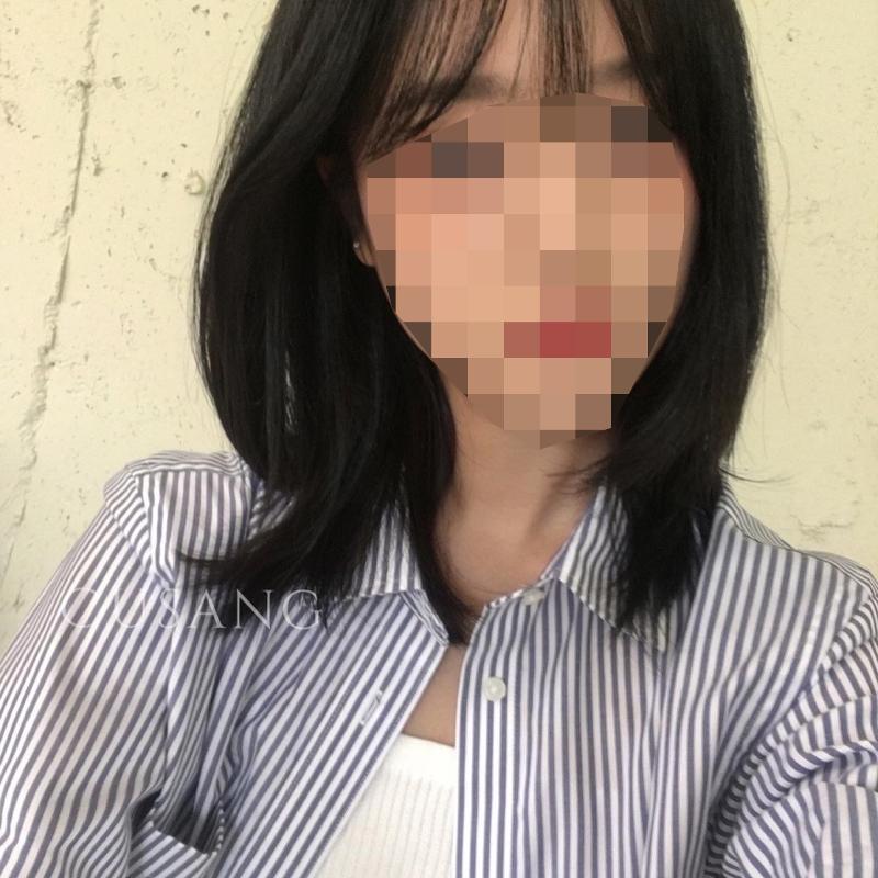 시술사진5>