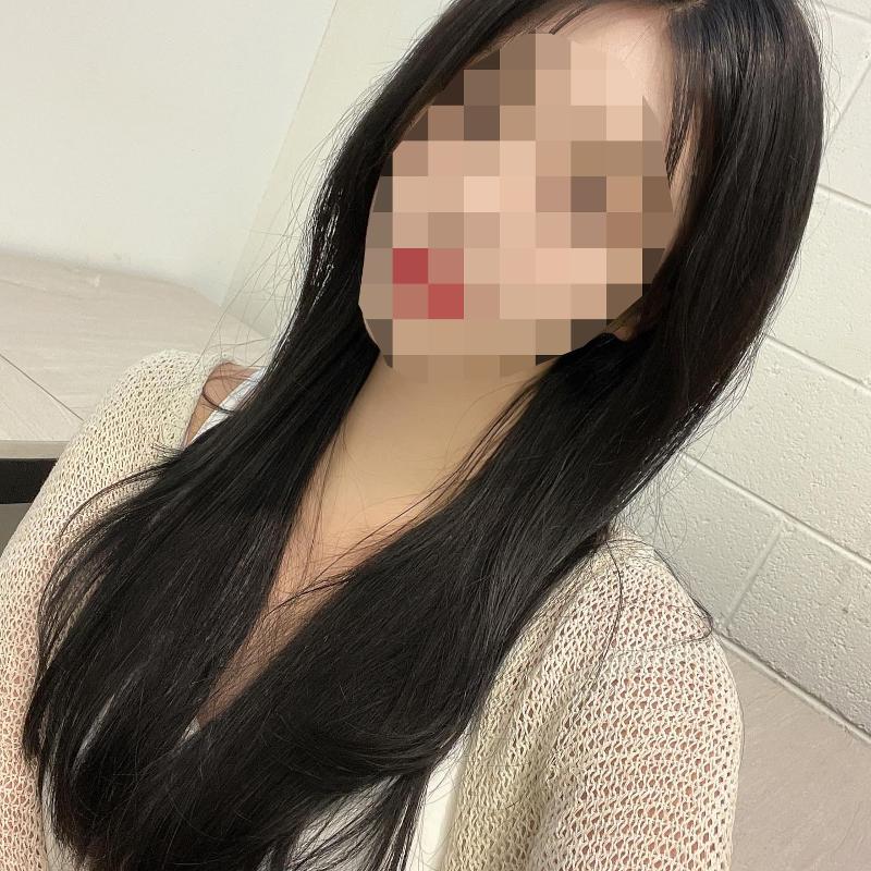 시술사진4>