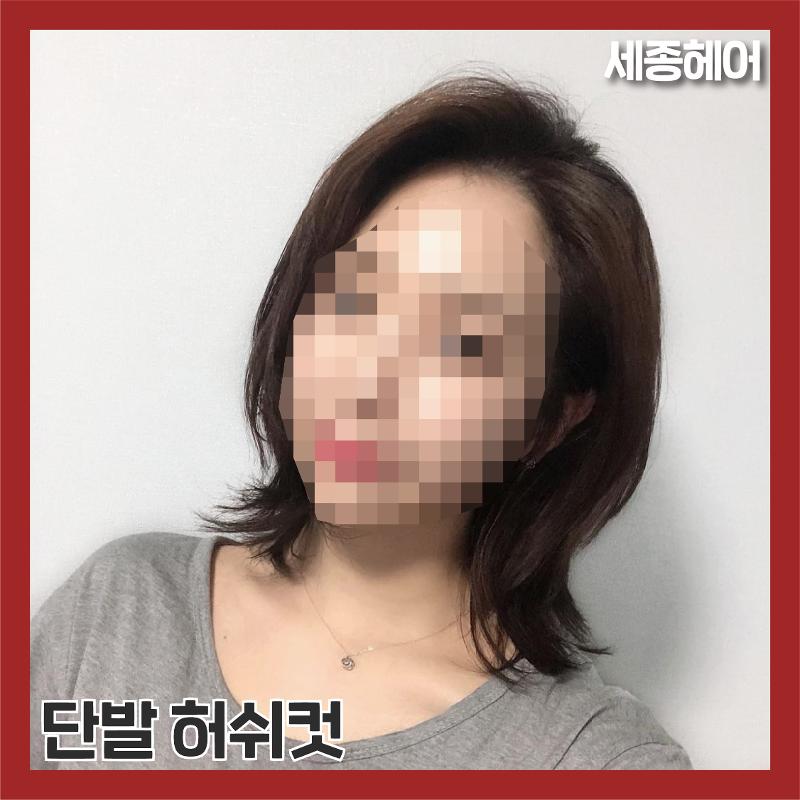 시술사진4>