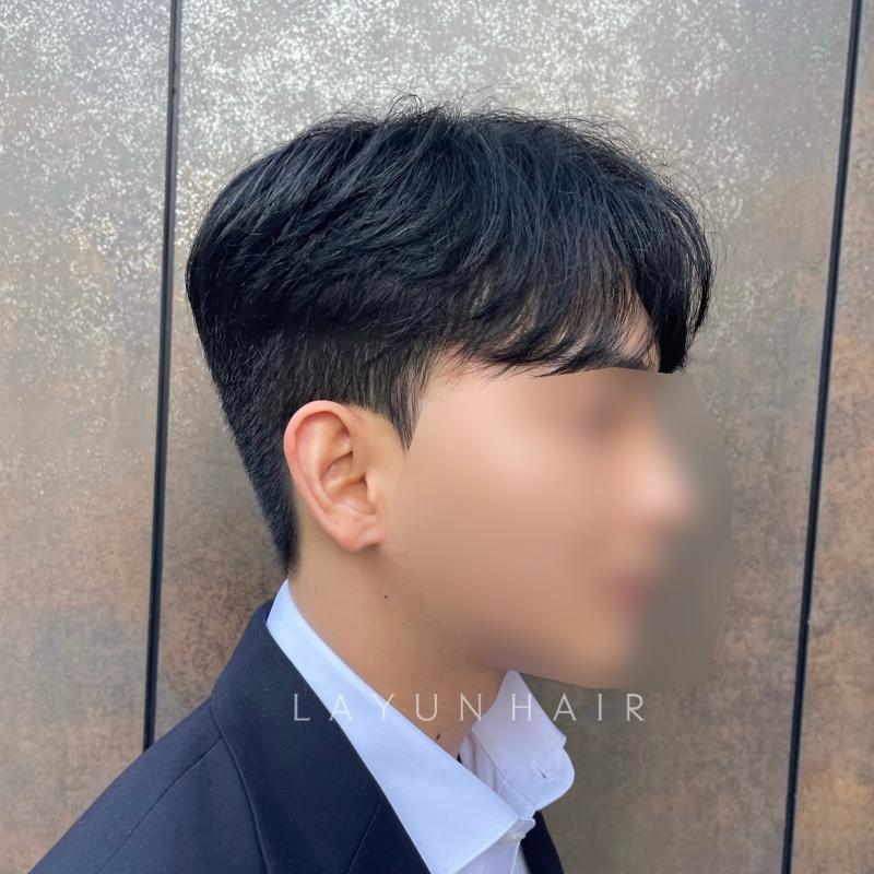 시술사진5>