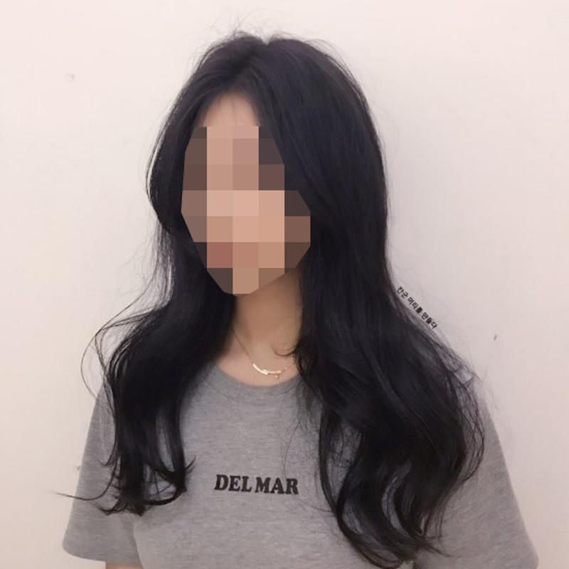시술사진1>