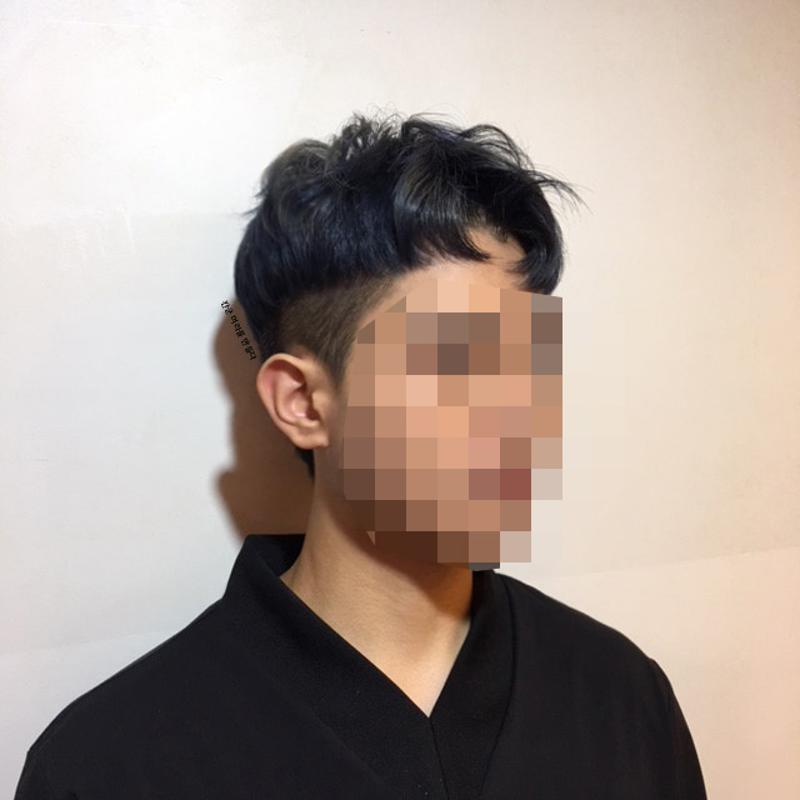 시술사진7>