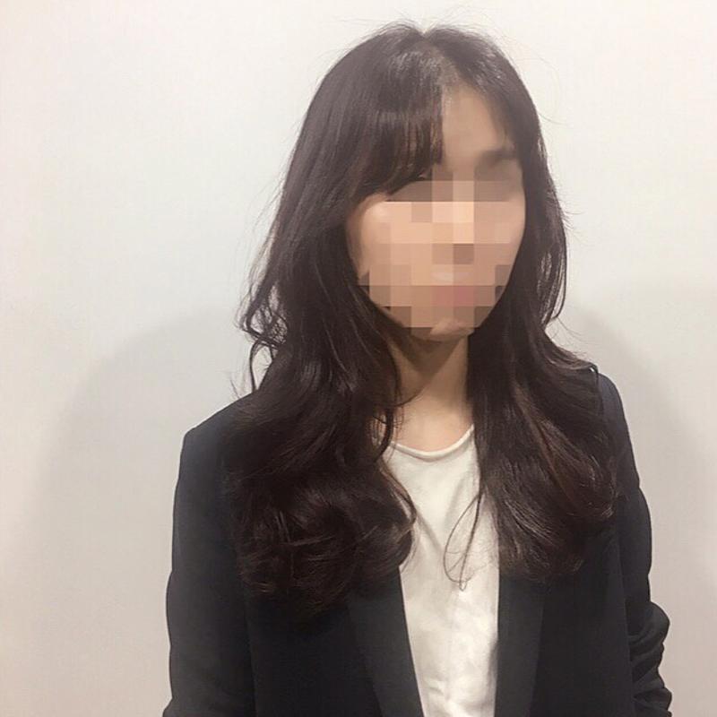 시술사진3>