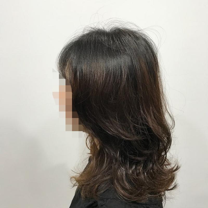 시술사진1>