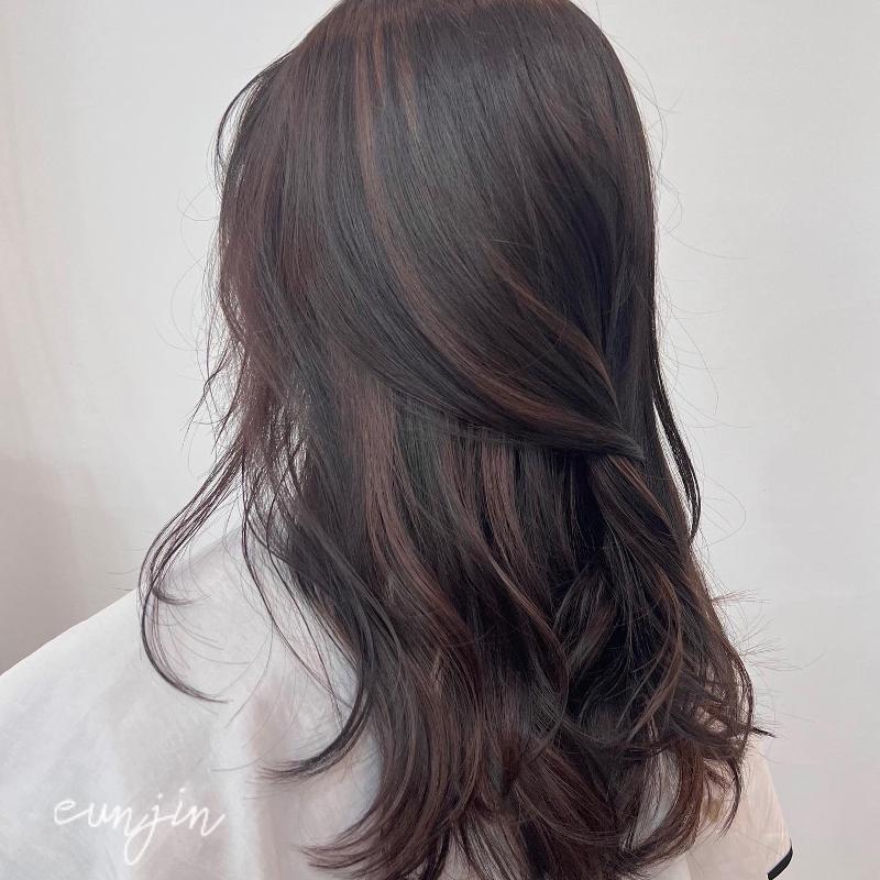 시술사진5>